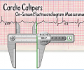 Cardio Calipers Скриншот 0