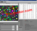 Pixcavator Image Analysis Software Скриншот 0