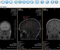 XRayline Workstation Screenshot 0